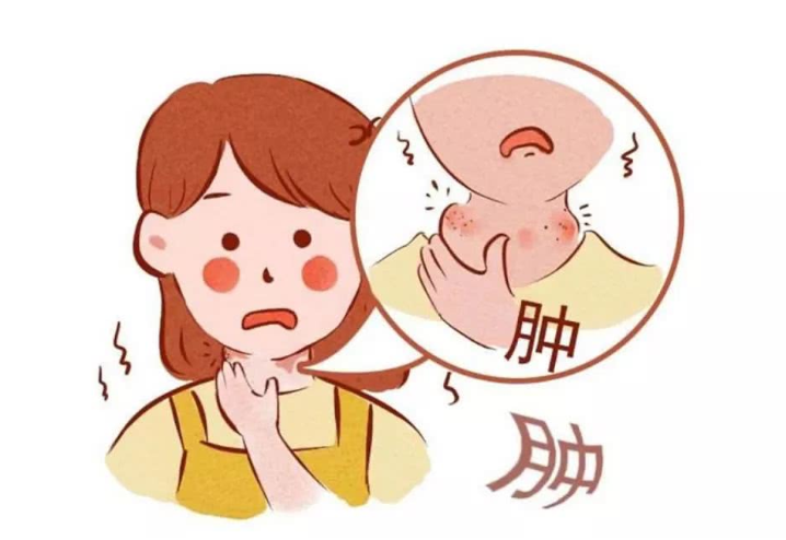 扁桃體發(fā)炎吃什么藥好得快？扁桃體發(fā)炎飲食禁忌有哪些？